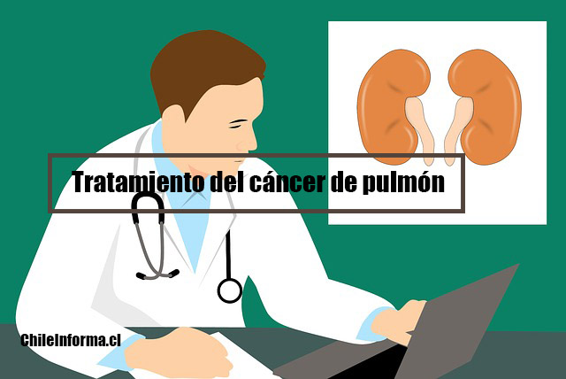 Cáncer de pulmón
