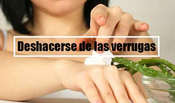 deshacerse de las verrugas